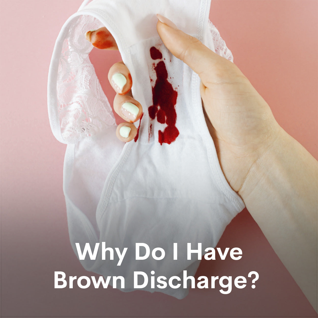 Brown discharge