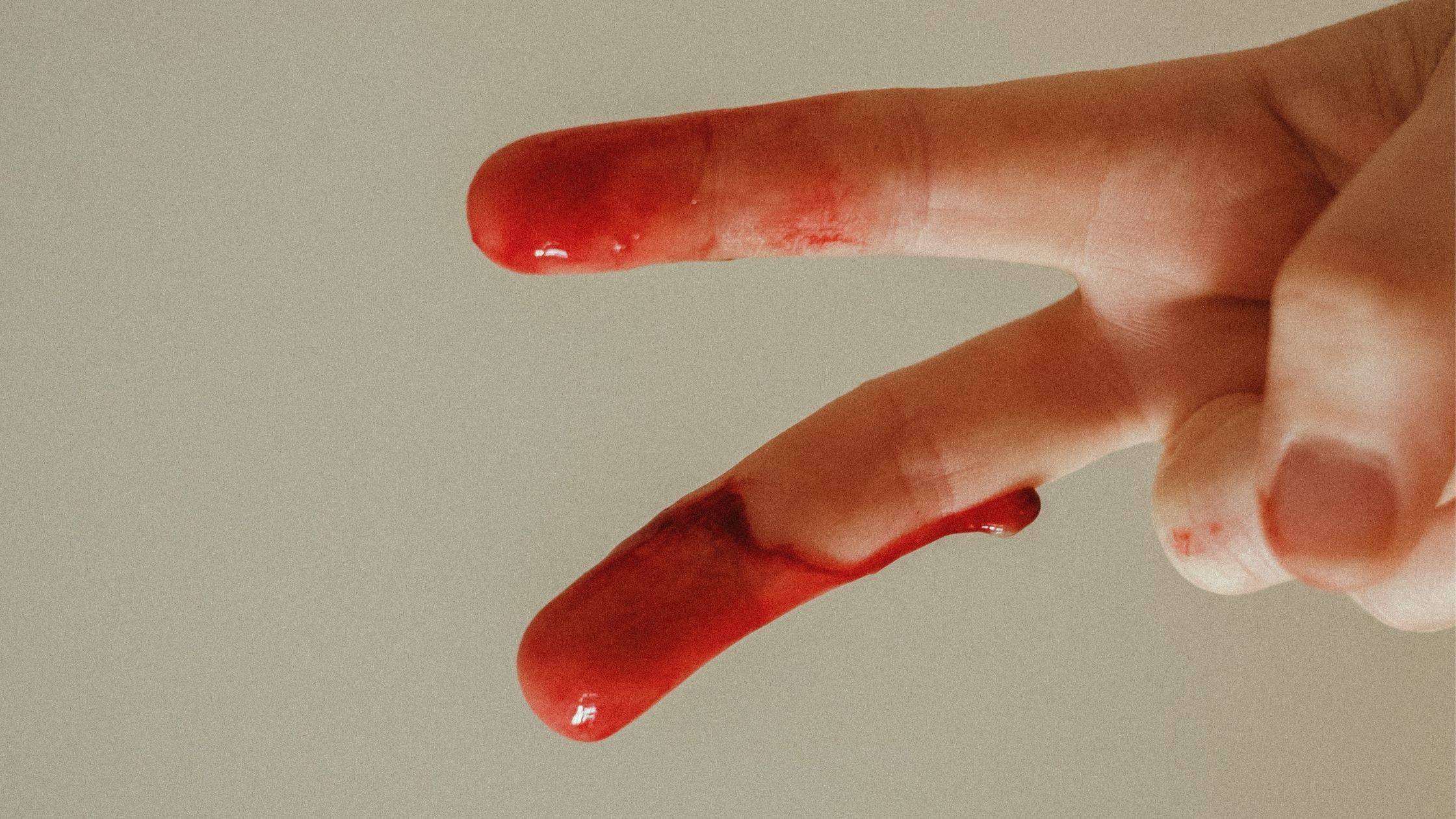 What does dried blood smell like? - Quora